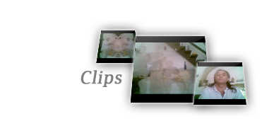 Clips